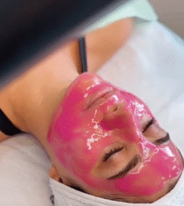 نمونه پاکسازی پوست (کلینیک تخصصی آفرینش)