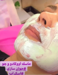 نمونه پاکسازی پوست (کلینیک زیبایی یاس)