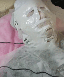 نمونه پاکسازی پوست (کلینیک زیبایی یاس)