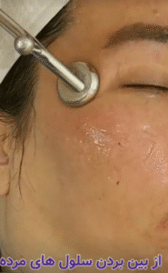 نمونه پاکسازی پوست (کلینیک زیبایی یاس)