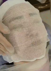 نمونه پاکسازی پوست (کلینیک زیبایی یاس)