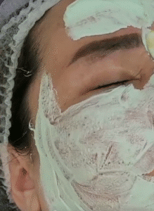 نمونه پاکسازی پوست (کلینیک زیبایی یاس)