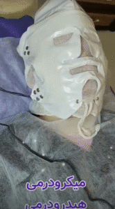 نمونه پاکسازی پوست (کلینیک زیبایی یاس)