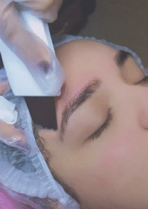 نمونه پاکسازی پوست (کلینیک زیبایی یاس)