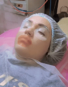 نمونه پاکسازی پوست (کلینیک زیبایی یاس)