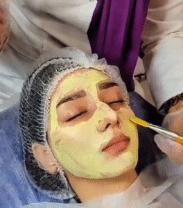 نمونه پاکسازی پوست (کلینیک زیبایی یاس)