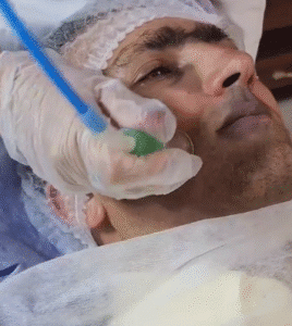 نمونه پاکسازی پوست (کلینیک زیبایی یاس)