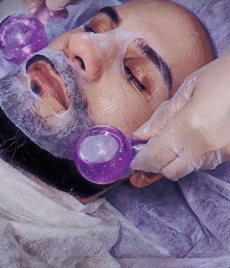 نمونه پاکسازی پوست (کلینیک زیبایی یاس)