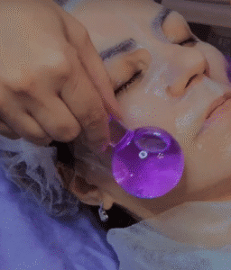 نمونه پاکسازی پوست (کلینیک زیبایی یاس)