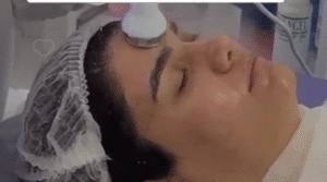 نمونه پاکسازی پوست (کلینیک زیبایی یاس)