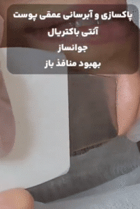 نمونه پاکسازی پوست (کلینیک زیبایی یاس)