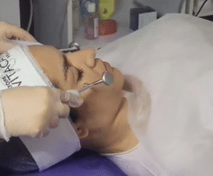 نمونه پاکسازی پوست (کلینیک زیبایی یاس)