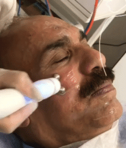 نمونه پاکسازی پوست (کلینیک زیبایی یاس)