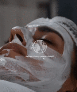 نمونه پاکسازی پوست کلینیک زیبایی ماهان