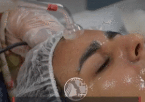 نمونه پاکسازی پوست کلینیک زیبایی ماهان