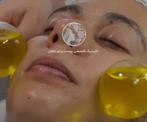 نمونه پاکسازی پوست کلینیک زیبایی ماهان