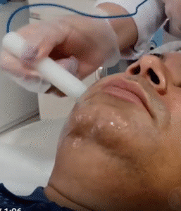 نمونه پاکسازی پوست کلینیک زیبایی ماهان