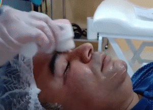 نمونه پاکسازی پوست کلینیک زیبایی ماهان