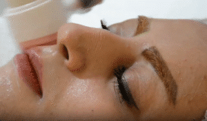 نمونه پاکسازی پوست کلینیک زیبایی ماهان