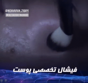 نمونه پاکسازی پوست کلینیک نوآوران زیبایی