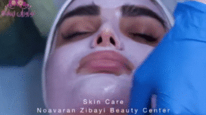 نمونه پاکسازی پوست کلینیک نوآوران زیبایی