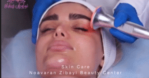 نمونه پاکسازی پوست کلینیک نوآوران زیبایی