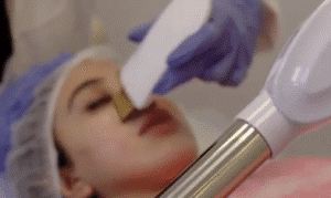 نمونه پاکسازی پوست کلینیک نوآوران زیبایی