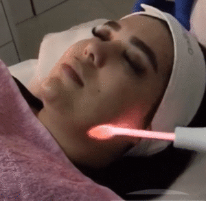 نمونه پاکسازی پوست کلینیک نوآوران زیبایی