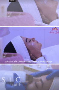 نمونه پاکسازی پوست کلینیک نوآوران زیبایی