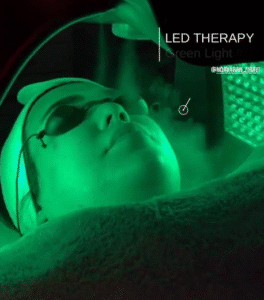 نمونه پاکسازی پوست کلینیک نوآوران زیبایی