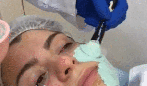 نمونه پاکسازی پوست کلینیک نوآوران زیبایی