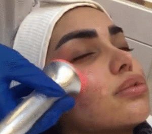 نمونه پاکسازی پوست کلینیک نوآوران زیبایی