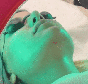 نمونه پاکسازی پوست کلینیک نوآوران زیبایی