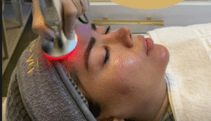 نمونه پاکسازی پوست کلینیک نوآوران زیبایی