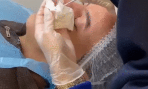 نمونه پاکسازی پوست کلینیک نوآوران زیبایی