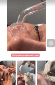 نمونه پاکسازی پوست کلینیک زیبایی پرنیان