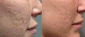 نمونه پاکسازی پوست کلینیک زیبایی پرنیان