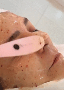 نمونه پاکسازی پوست کلینیک زیبایی پرنیان