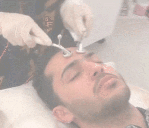 نمونه پاکسازی پوست کلینیک زیبایی پرنیان