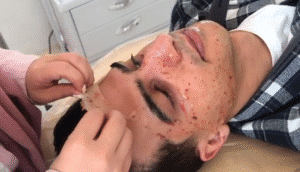 نمونه پاکسازی پوست کلینیک زیبایی پرنیان