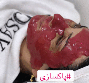 نمونه پاکسازی پوست کلینیک زیبایی اسپادانا