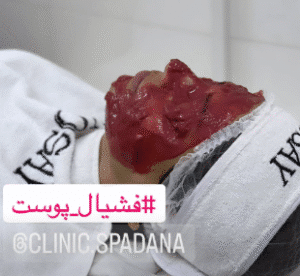 نمونه پاکسازی پوست کلینیک زیبایی اسپادانا