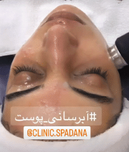 نمونه پاکسازی پوست کلینیک زیبایی اسپادانا
