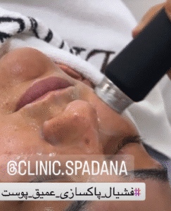 نمونه پاکسازی پوست کلینیک زیبایی اسپادانا