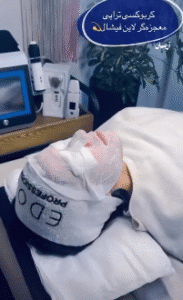 نمونه پاکسازی پوست کلینیک زیبایی آرمان