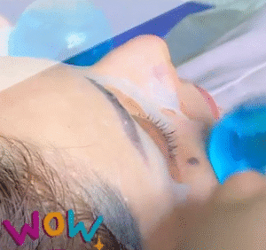 نمونه پاکسازی پوست کلینیک گلدن رویال