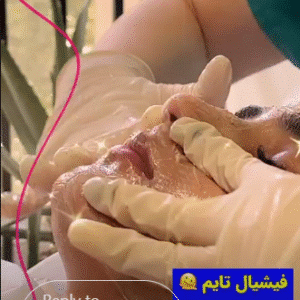 نمونه پاکسازی پوست کلینیک گلدن رویال