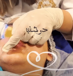 نمونه پاکسازی پوست کلینیک گلدن رویال