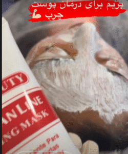 نمونه پاکسازی پوست کلینیک گلدن رویال