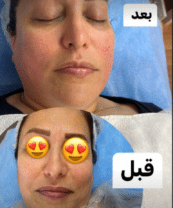 نمونه پاکسازی پوست کلینیک گلدن رویال